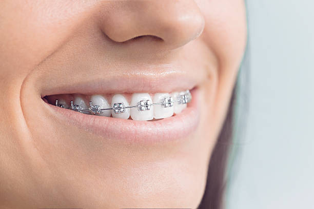 Best Wisdom Tooth Removal  in Ninnekah, OK